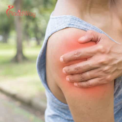 Rotator Cuff Stem Cell Therapy in Mexico: Comprehensive Guide to Costs, Procedures, and Recovery